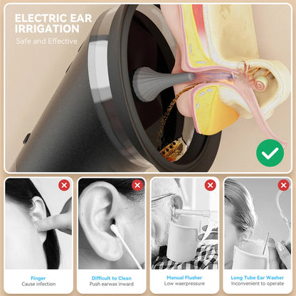 Nuvexpro-Kit de nettoyage d'oreille électrique